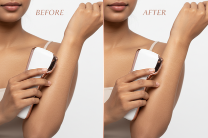 Before and After Arms - Product in Use